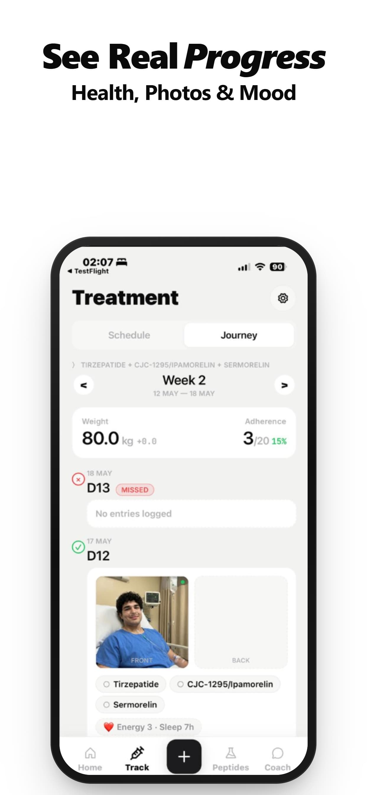 PeptPro app — journey screen with progress photos, weight and adherence